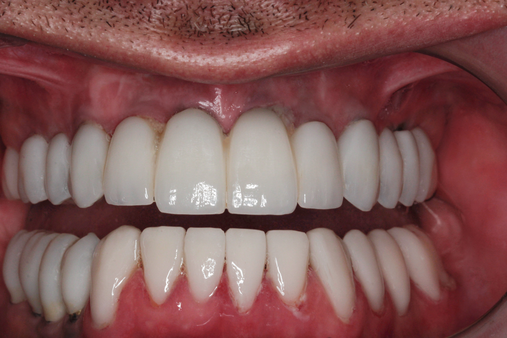 cosmetic-dentistry-after-48