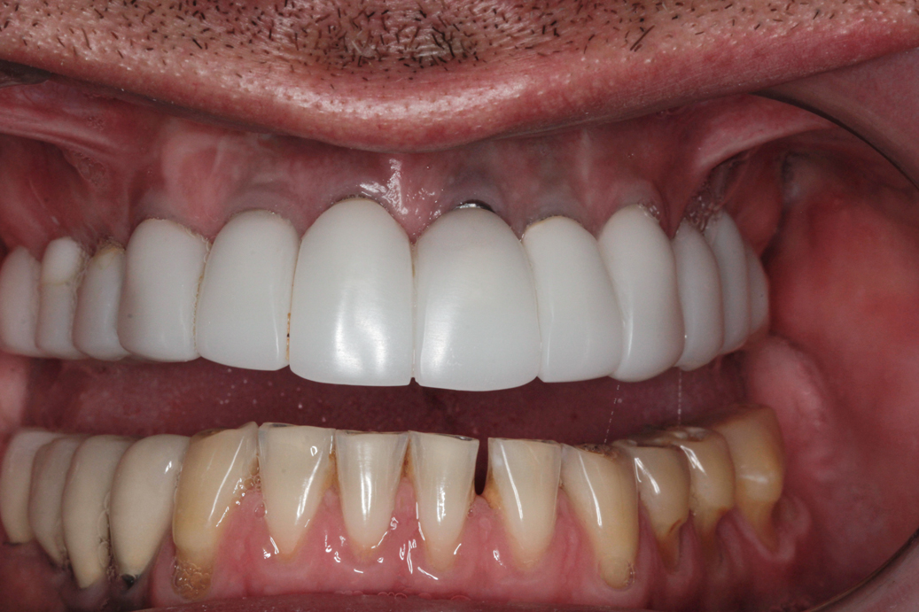cosmetic-dentistry-before-48