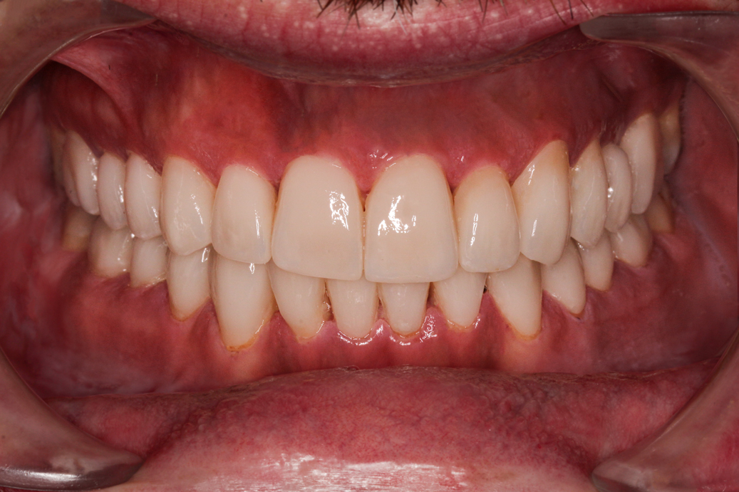 cosmetic-dentistry-after-case-91
