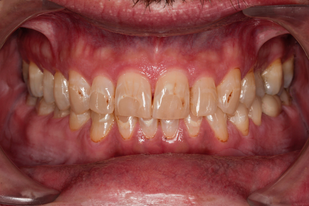 cosmetic-dentistry-before-case-91